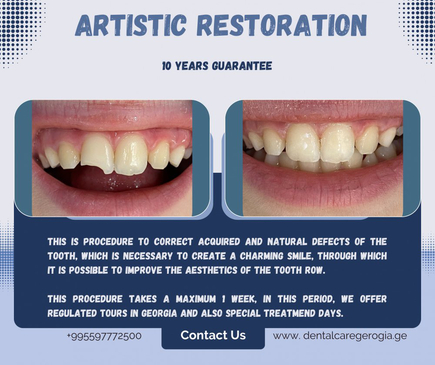 Slider image (2) Universe Dental - Best Dental Clinic in Tbilisi, Georgia